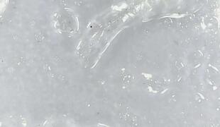 Algen-Glibber unter dem Mikroskop