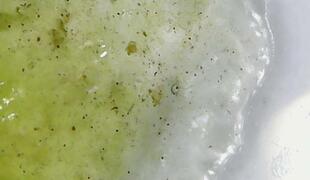Algen-Glibber unter dem Mikroskop